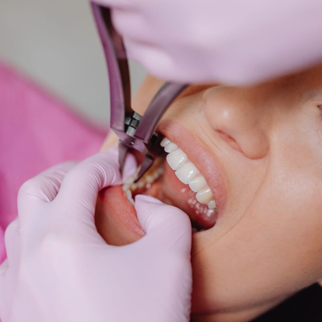 Wisdom tooth extraction in Gurgaon at RNC Dental
